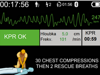 DefiSign Pocket Plus ECG-Weergave Optie  - 11527